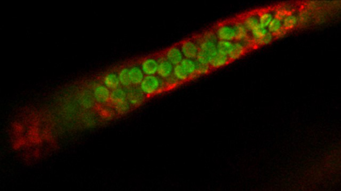 人間も光合成できるかも？血中に藻類を注入して細胞に酸素を与える実験が成功！の画像 2/3
