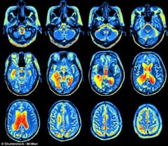 脳にAIを埋め込んで「気分を変える」実験が行われる(米研究)の画像 2/2