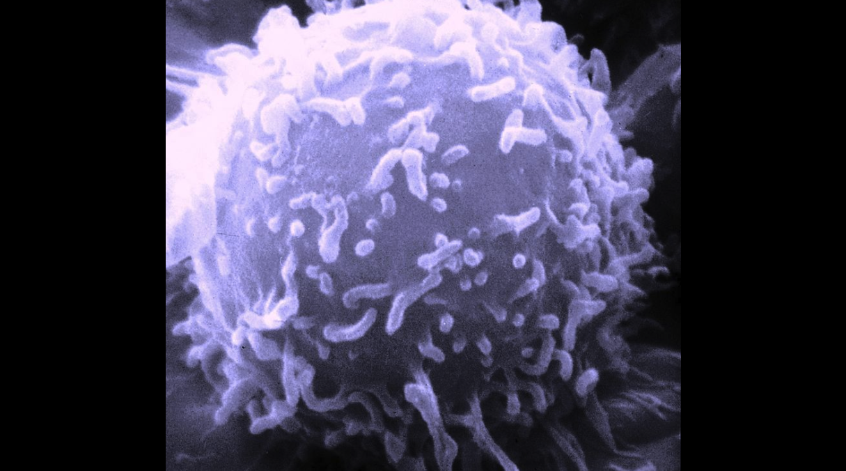 あらゆる癌細胞を攻撃できる「万能型」免疫細胞が発見されるの画像 2/4