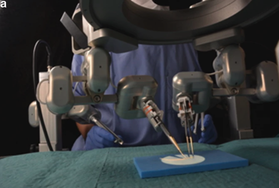 “手術お助けロボット”による超マイクロ手術が初めての臨床実験に成功の画像 2/3