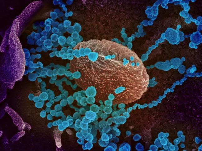 新型コロナウイルスは「免疫細胞を無効化する」という研究結果の画像 1/4