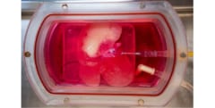 iPS細胞から培養した「ヒト肝臓」をラットへ移植することに成功！　ドナー不足問題に明るい兆しの画像 1/5