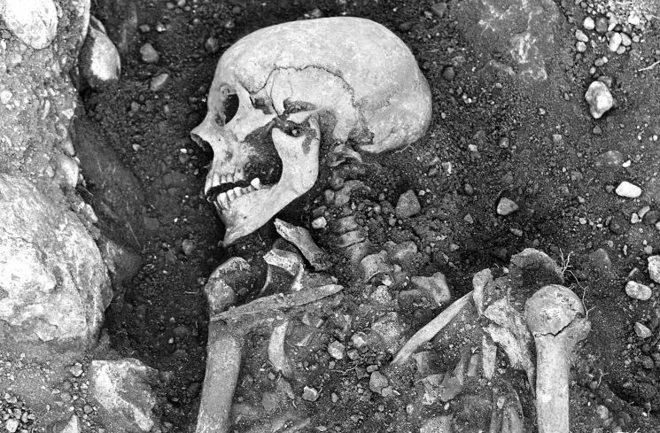 1400年前のヴァイキングの歯から「天然痘ウイルス」を発見！　20世紀に根絶したものと遺伝子が違っていたの画像 1/4