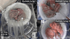 損傷したヒト肺を「豚に移植して回復させる」ことに成功！　生体だけに含まれる未知の物質の存在が示唆されるの画像 3/5