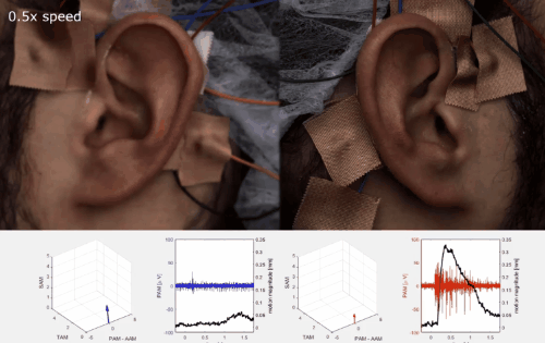 人は興味のある音を聞くとき「誰でも耳をピクピクできる」と判明！　制御する脳領域が神経化石として残っていた！の画像 4/5