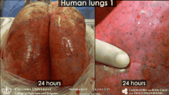 損傷したヒト肺を「豚に移植して回復させる」ことに成功！　生体だけに含まれる未知の物質の存在が示唆されるの画像 4/5