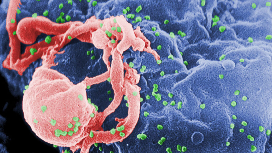 エイズを「自然治癒」させた超免疫持ちの人間が発見される
