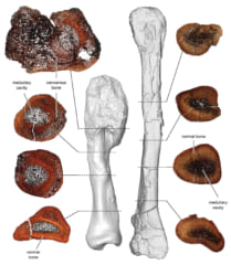 史上初、恐竜がヒトと同じ「骨のがん」に罹っていた証拠を発見！　がんの進化を解明する上で貴重な資料にの画像 3/3