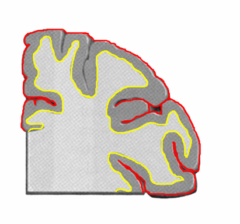 大脳皮質（黄線と赤線の間）