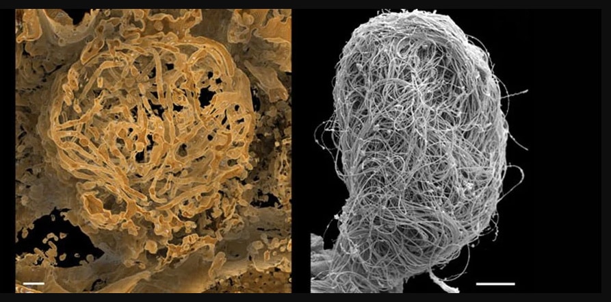 貝形虫類の巨大精子の3D画像