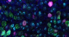 マゼンタで色付けされた膀胱内の信号と、シアンで色付けされたセンサータンパク質「PIEZO2」を検出する感覚ニューロン。
