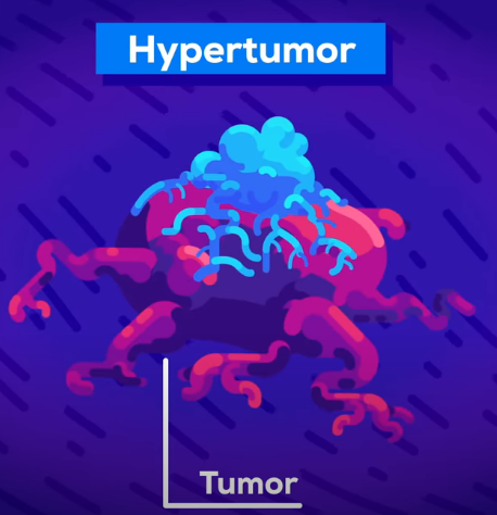 腫瘍にできる腫瘍「ハイパー腫瘍」