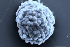 水素を生成する藻類細胞の電子顕微鏡画像。スケールバーは10マイクロメートル。