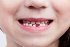 乳歯は強力な永久歯が完成するまでの代役だった