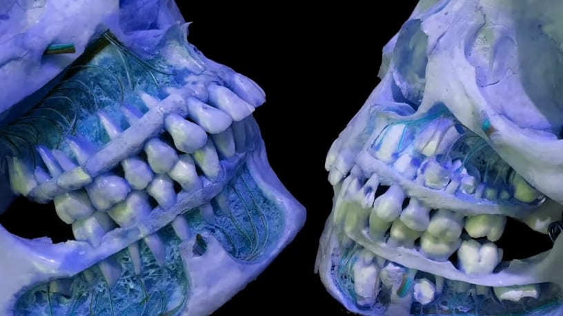 なぜヒトの歯は一度生え変わるのか？