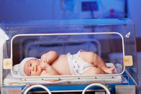 赤ちゃんは生まれて間もない状態で、何らかの治療を必要とすることもある。