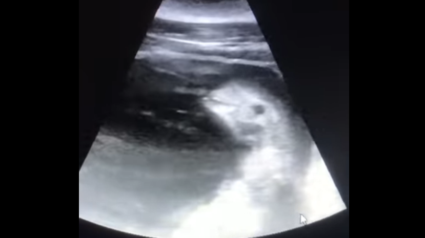 超音波ビデオで映し出されたシロイルカの赤ちゃん