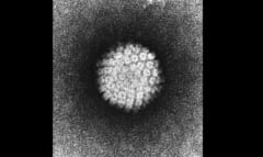 ヒトパピローマウイルスの電子顕微鏡画像。