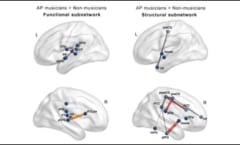 音楽家の脳、機能面・構造面ともに接続レベルが高い