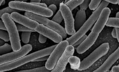 大腸菌は腸内微生物の全体のなかで、わずか0.1%に過ぎないが多くの問題を引き起こす