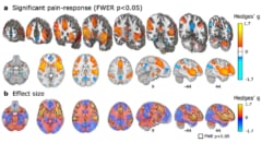 プラセボ効果による脳神経活動を記録