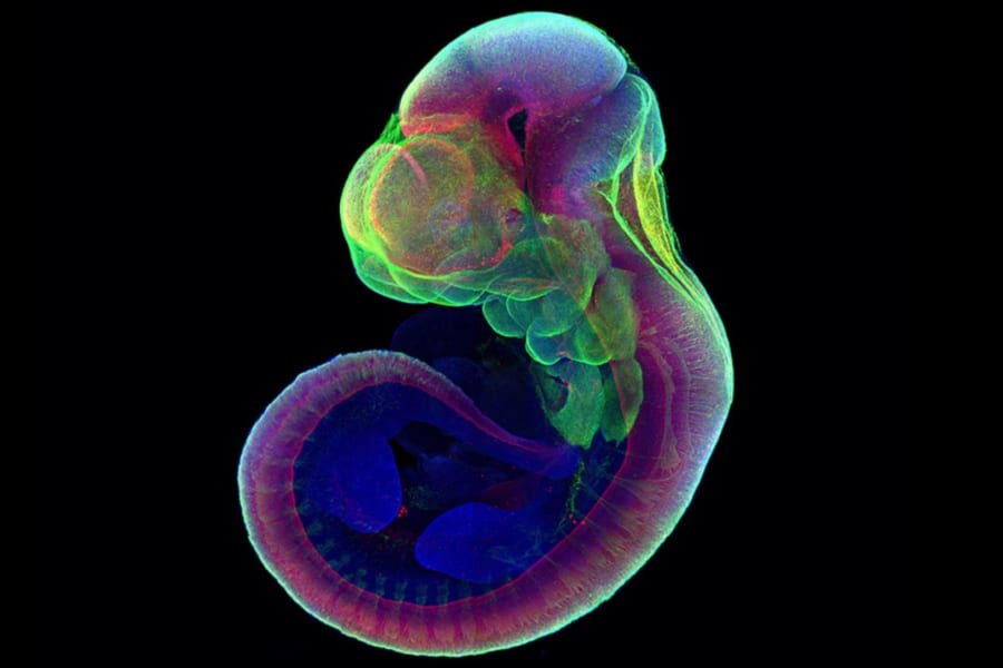 人工子宮でマウスの受精卵を「胎児」まで成長させることに成功
