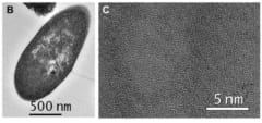 バクテリア断面図の電子顕微鏡。（C）細菌断面内の低倍率画像。