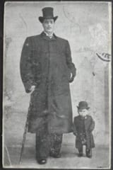 成人後のアダム（左）、右は小人症の人