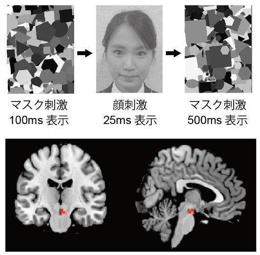 サブリミナルの顔表示（上）、自分の顔に反応したときの脳活動（下）