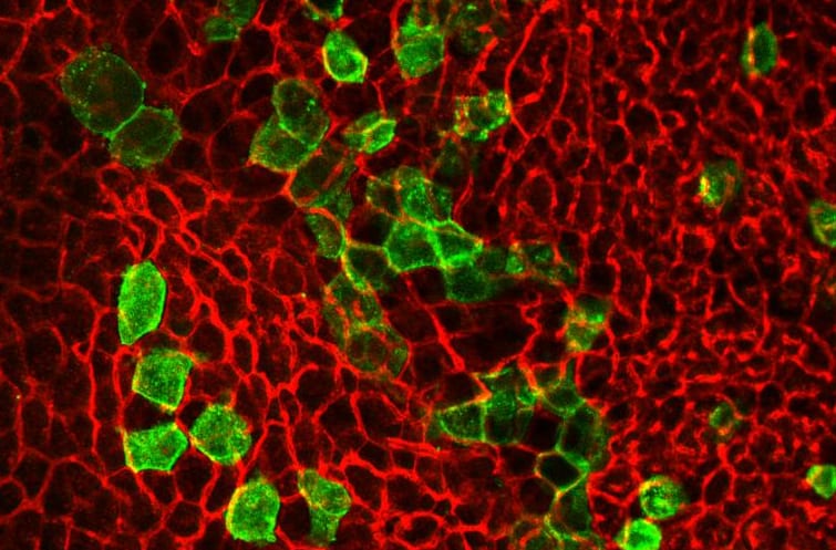 緑の部分が他の細胞から熱発生脂肪（褐色脂肪）に代わった細胞