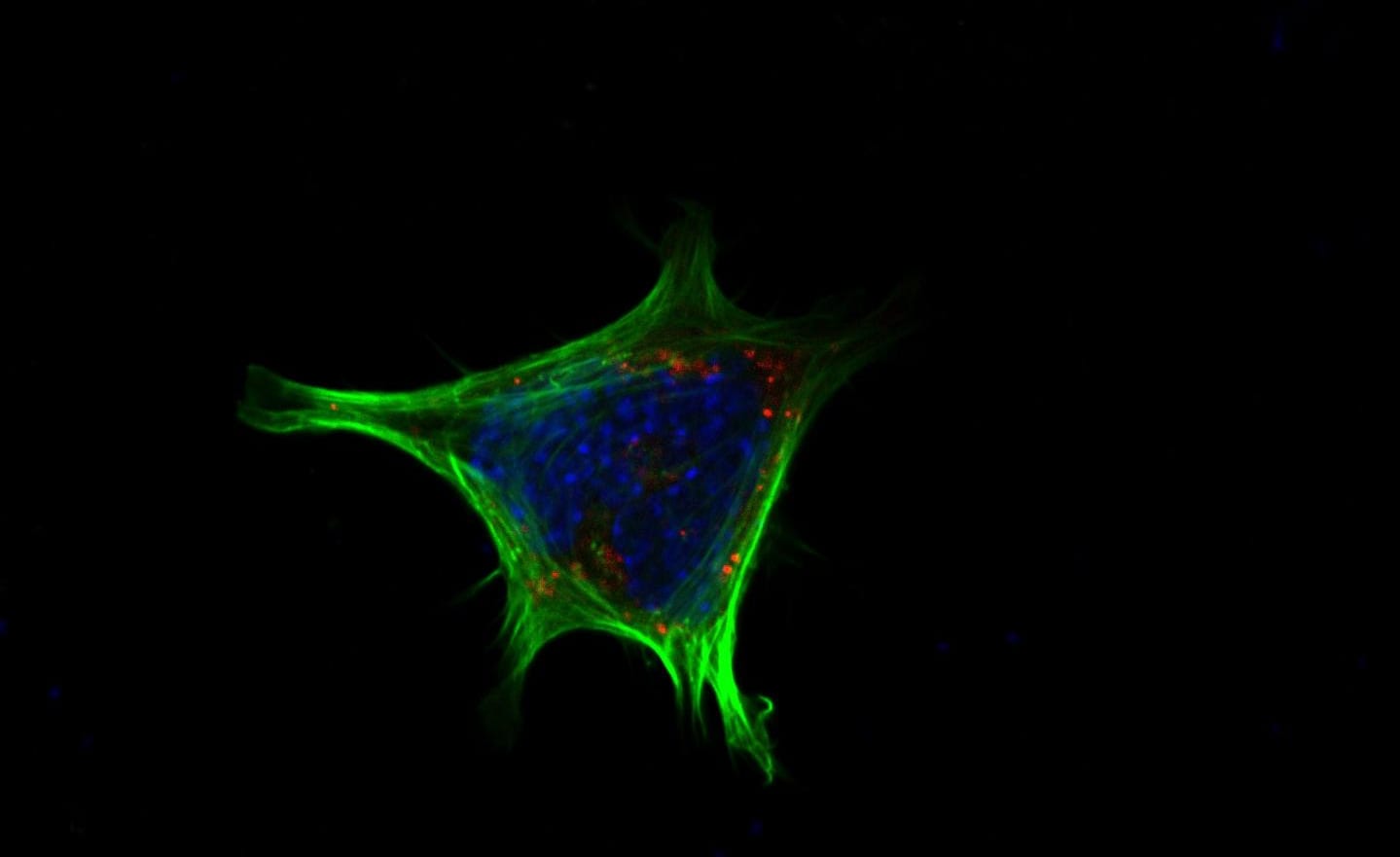 アクチン細胞骨格（緑）を染色したもの。この細胞で、TGR5が活性化すると細胞質にNPY（赤）が蓄積されて、その放出がブロックされる