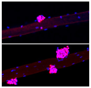 山中因子（OKSM）を筋線維に誘導すると、筋原性前駆細胞の数が増加する。上は何も手を加えていないもの、下が処置を施したもの。赤-ピンクは筋幹細胞マーカーであるPax7。青は筋核を示す。