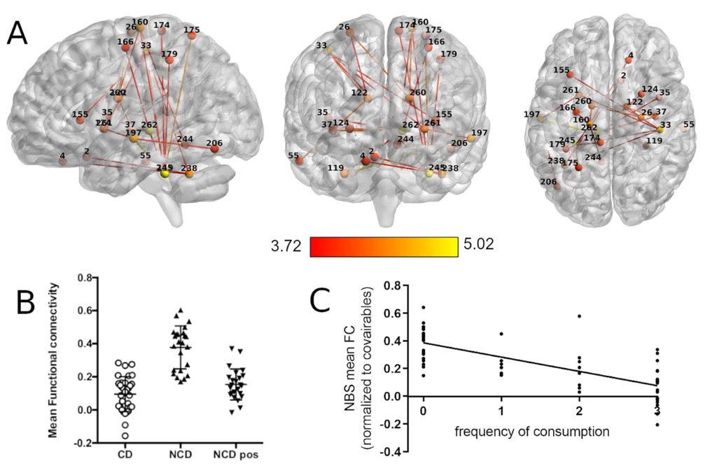 (A)コーヒー常飲者の接続性が低下した脳内ネットワーク, (B)グループごとの接続性。コーヒー常飲者の値は低く、非常飲者もコーヒーを飲んだ後は一時的に低くなる, (C)カフェイン飲料の消費頻度と脳接続性の関係