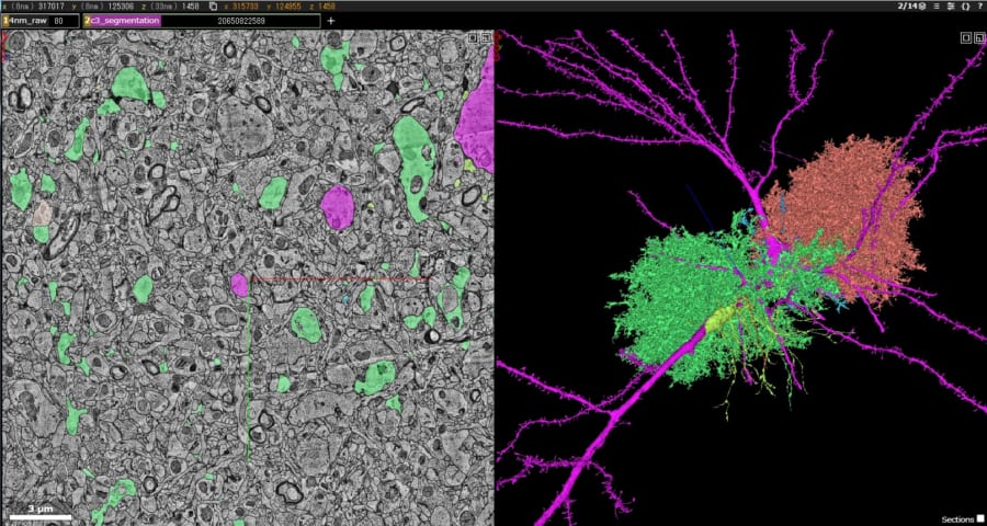左が脳の断面図。右が断面をつなげた3Dマップ。左の色のついた細胞は、右の3Dのモデルの色と一致している。