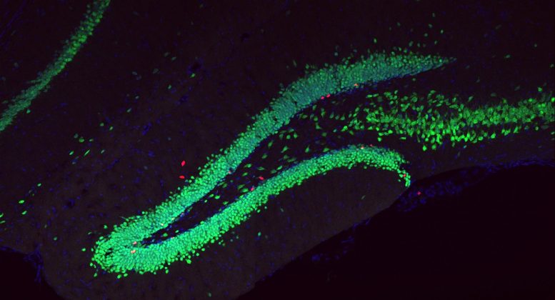 海馬の神経発生。赤は新しい神経細胞