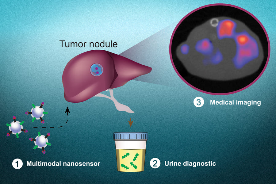 尿検査と画像から「がんの有無と位置まで」わかる薬品が開発される