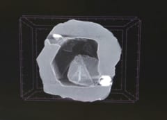 マトリョーシカ・ダイヤモンドのX線写真