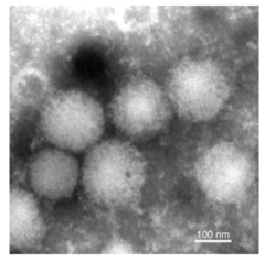 エゾウイルス粒子の電子顕微鏡写真。
