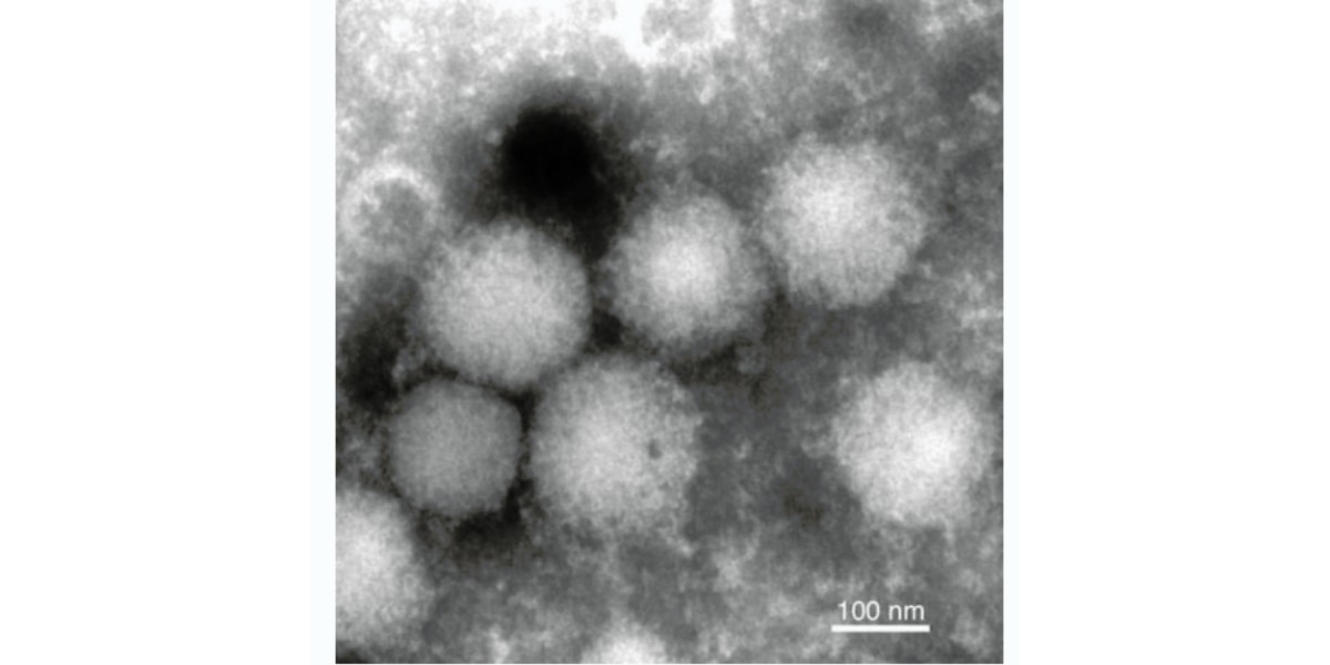 エゾウイルス粒子の電子顕微鏡写真