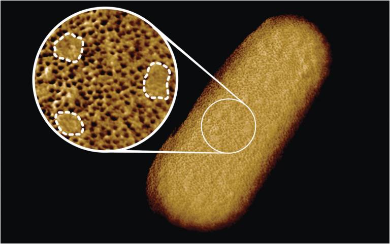 細菌の「薬剤バリア」は穴だらけだったと鮮明な画像から明らかに