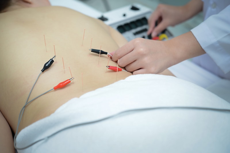 電気鍼治療は鍼に電気を流すことで電気刺激によって鍼治療の効果を高めるという現代版鍼治療