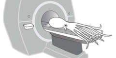 生息域の異なるタコの脳をMRIでスキャンしてみた