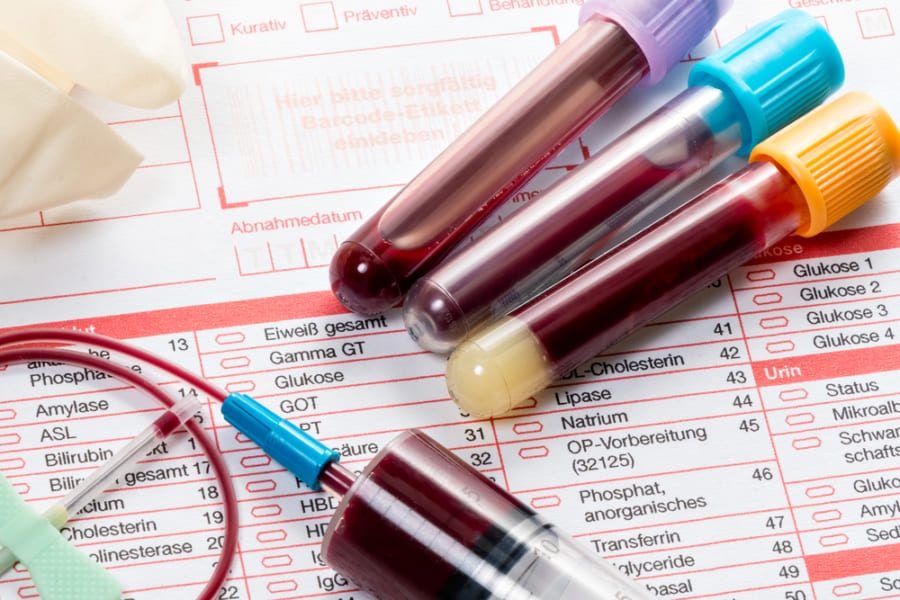 ２型糖尿病発症の兆候を19年前から予想できる血液検査が登場