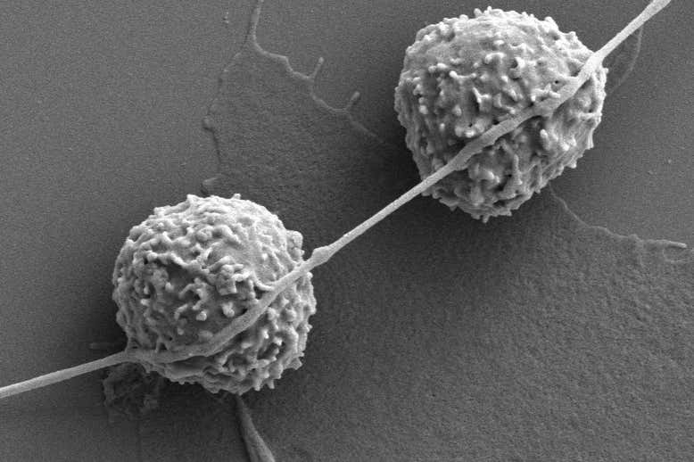 がん細胞が免疫細胞からミトコンドリアを吸っていると判明！