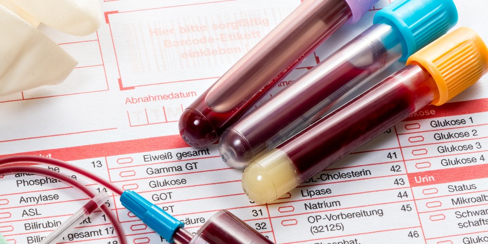 血液検査で2型糖尿病を予測できる