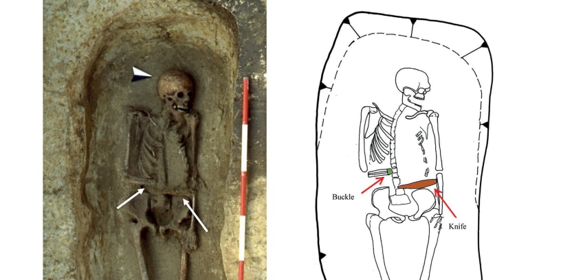 右腕を「刃の義手」にした中世イタリアの戦士の遺体が見つかる