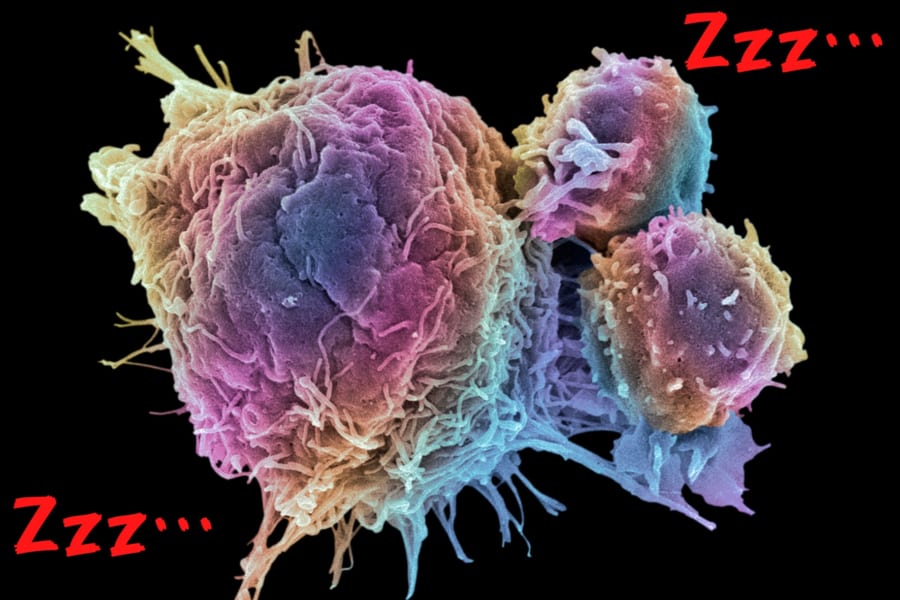 がん細胞を強制的に「眠らせる」薬剤を発見！　