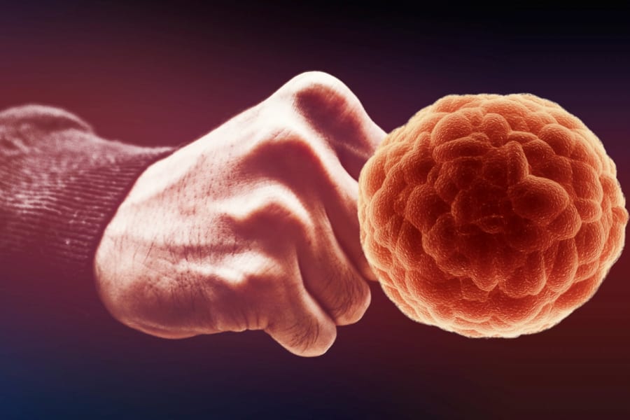 がん細胞を強制変異でステルス解除させ免疫に殴らせる治療法が開発