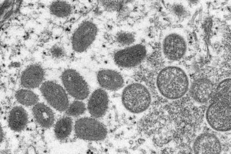 天然痘の治療薬が「サル痘」にも効果があると発表
