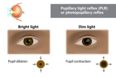 瞳孔の大きさで入る光量が変わる。瞳孔を小さくするとピントが合わせやすくなる